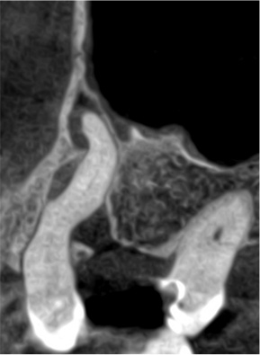 CBCT evaluation